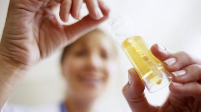análise de urina com цистите