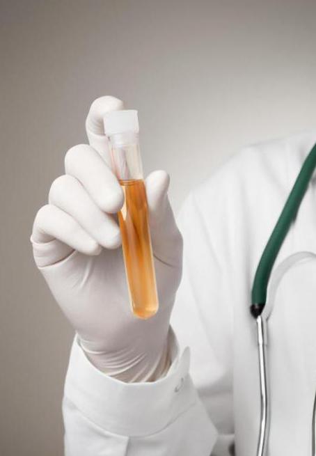 what will the urine in cystitis