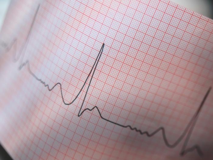 kalp Cardiogram deşifre