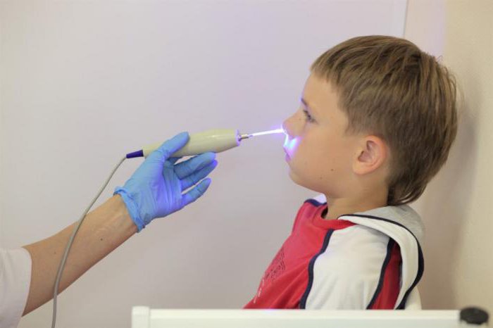 Laser die Behandlung von Polypen bei Kindern Bewertungen