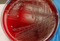 粪肠球菌-它是什么？ 症状和治疗