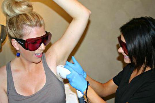 laser hair removal underarms