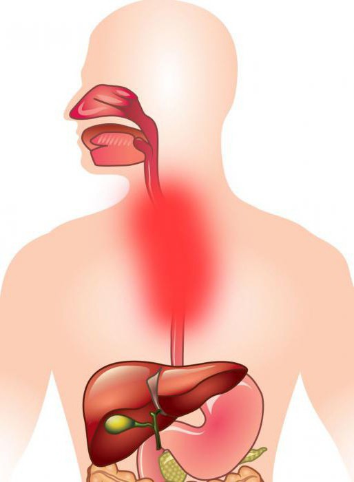 an ulcer of the esophagus symptoms and treatment