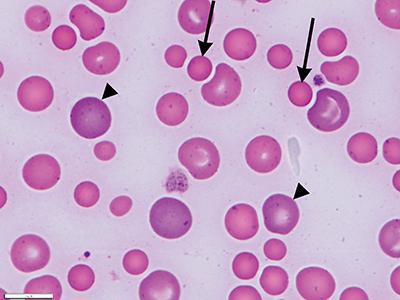 低anisocytosis的红细胞
