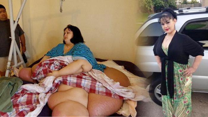 é muito espessa, as pessoas que perder peso foto de antes e depois