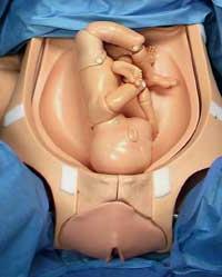 的纵向位置的胎儿