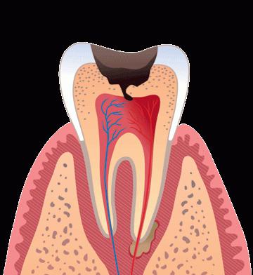 的疾病的牙齿和口腔