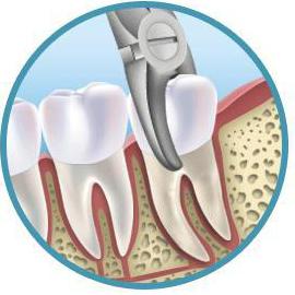歯痛の治療