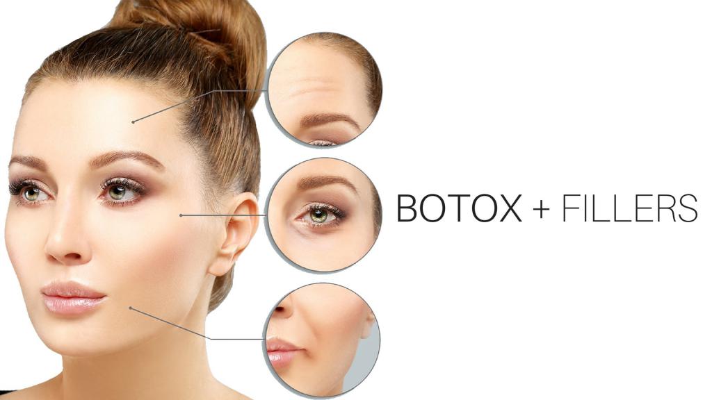 Botox-充填剤