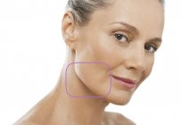Beauty-Injektionen für das Gesicht: Bewertungen