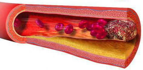 blood clotting anticoagulant system regulation of blood coagulation