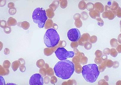 co to jest leukocyty w krwi