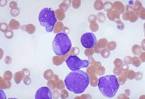 Як підвищити вміст лейкоцитів в крові
