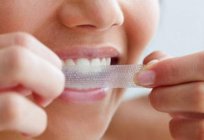 आधुनिक दंत चिकित्सा: एक दांत whitening