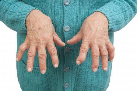 arthritis of the fingers