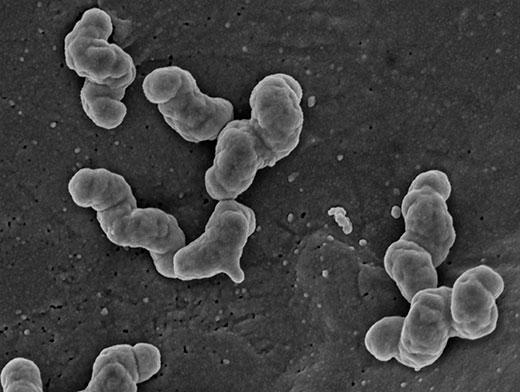 फ़ीड प्रकार nitrifying बैक्टीरिया