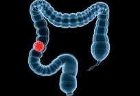 O gastroenterologista dizer como verificar o intestino