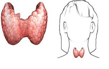 la glándula Tiroides aumentada de los síntomas