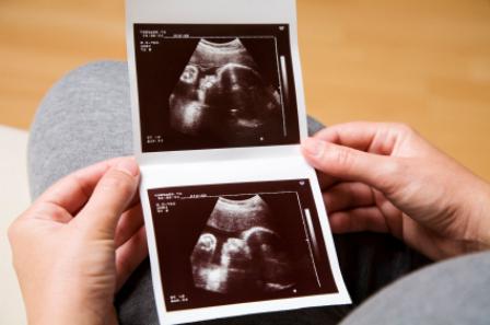 12 Wochen der Schwangerschaft Ultraschall-Screening