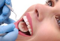 金属上前的牙齿是一个可靠的方法保护