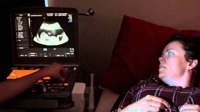 screening of trimester 1 standards for ultrasound photo