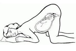 Knie-Ellen Position in der Schwangerschaft