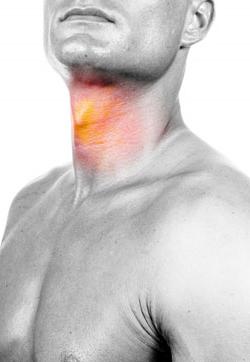Types of sore throat photo