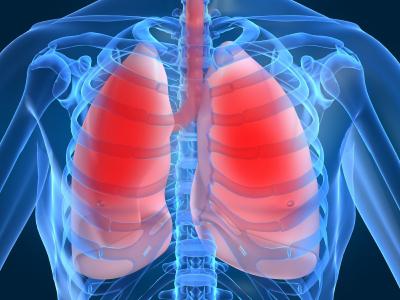 Kronik obstrüktif akciğer hastalığı