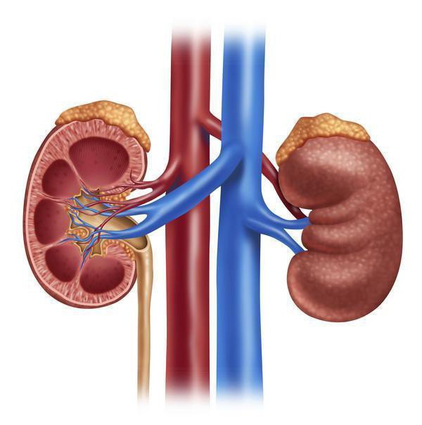 The Renal Pelvis Is Expanded In The Newborn Pyelectasis Kidney In A Child