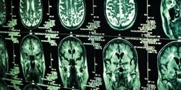 Nedenleri beyin kanseri