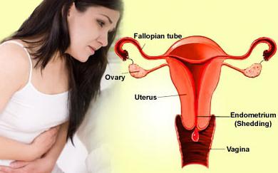 la menstruación no cesan por qué