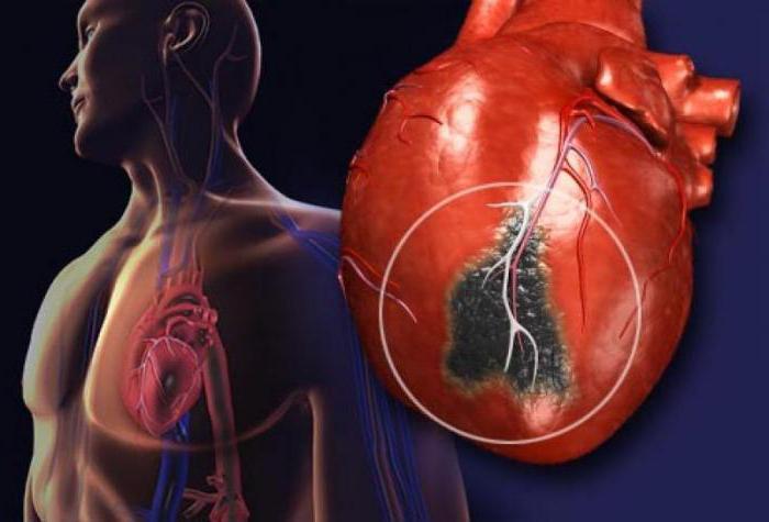 фракція викиду серця норма після інфаркту