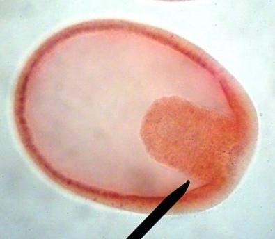 胚胎是
