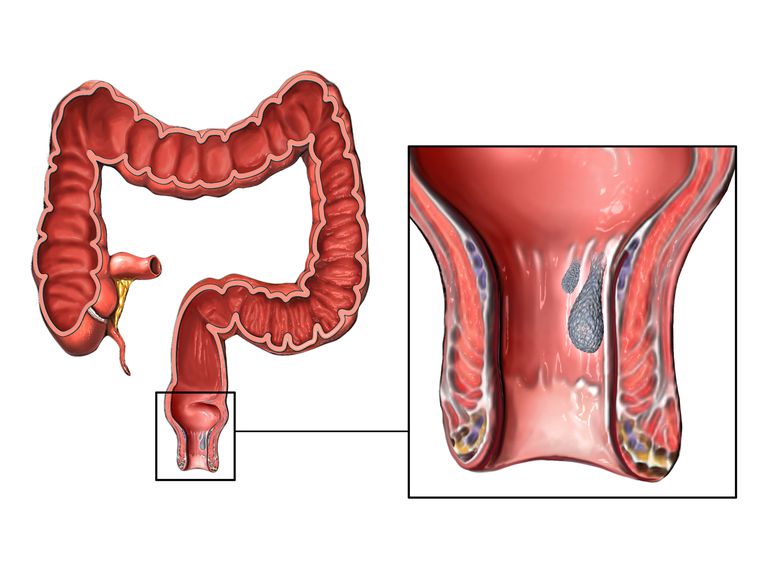 the Structure of the intestine