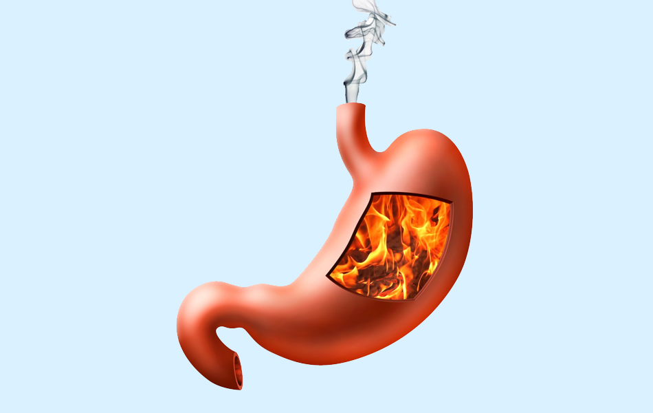 什么胃灼热可以帮助药物治疗