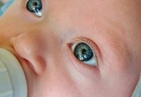 Кон'юнктивіт у немовляти: причини, лікування, профілактика