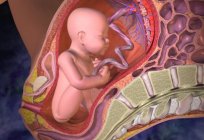 Os sintomas do descolamento de placenta em diferentes épocas, a primeira ajuda ao estado