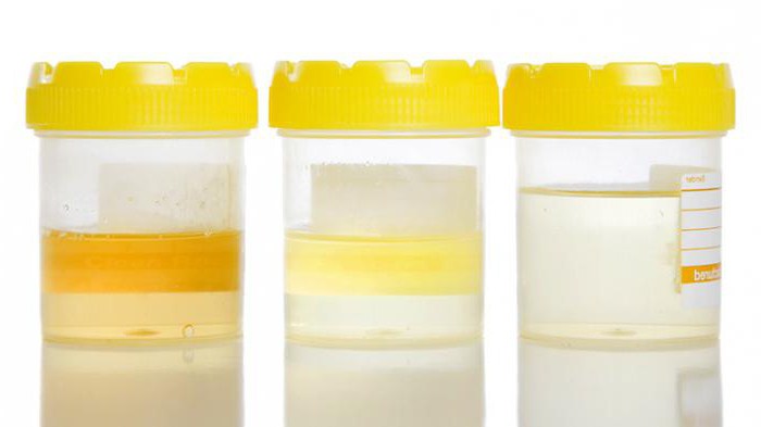 the color of urine of a healthy person
