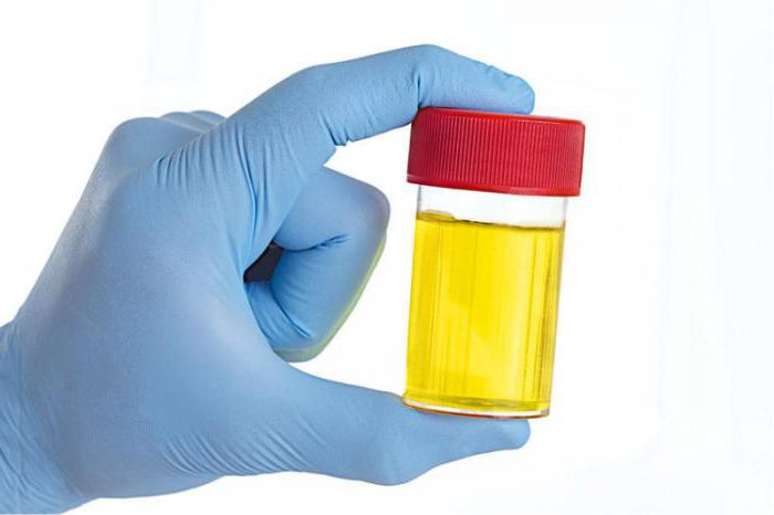 the color of urine of a healthy person photo