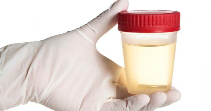 what is the normal color of urine from a healthy person