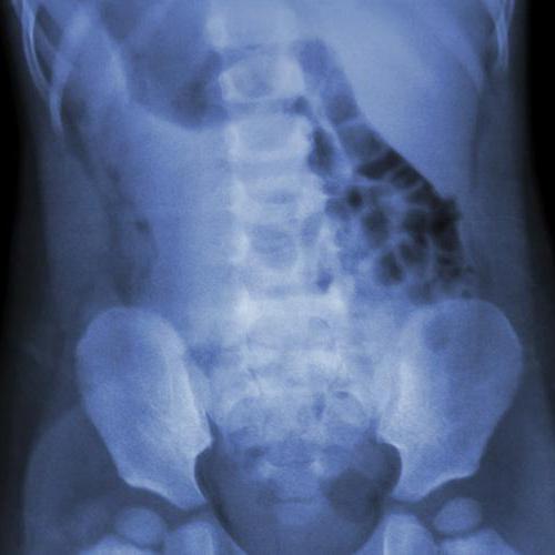 x-ray في العمود الفقري القطني السعر