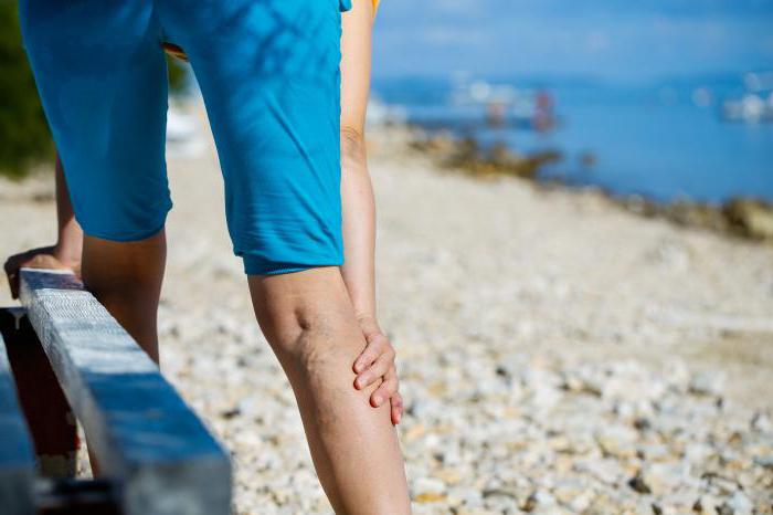 wie zur Behandlung von Krampfadern an den Beinen bei Männern Medikamente