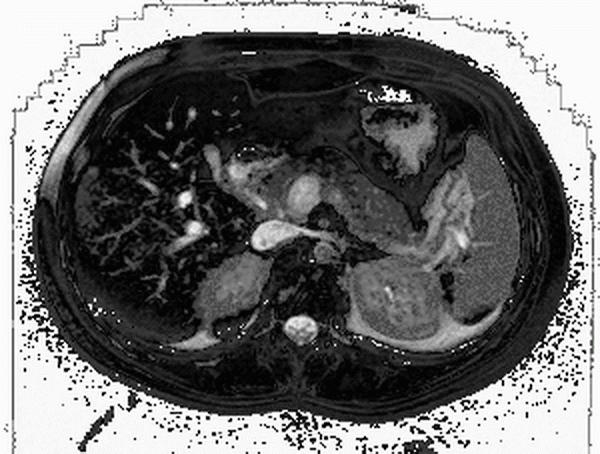 MRI of the small pelvis in women reviews