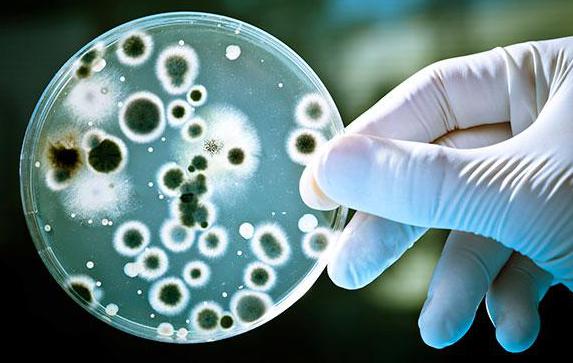 the Microorganisms in the Petri dish