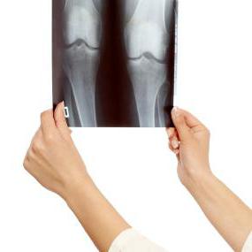 dolor en la rodilla causas