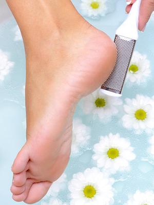 why cracked heels causes