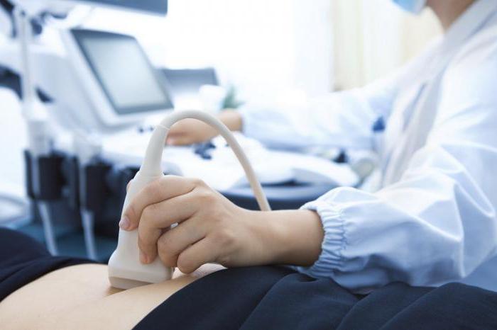 ultrasound examination of abdominal cavity Ekaterinburg