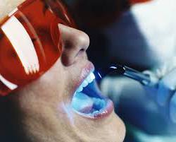 Clareamento dos dentes em odontologia - contra-indicações