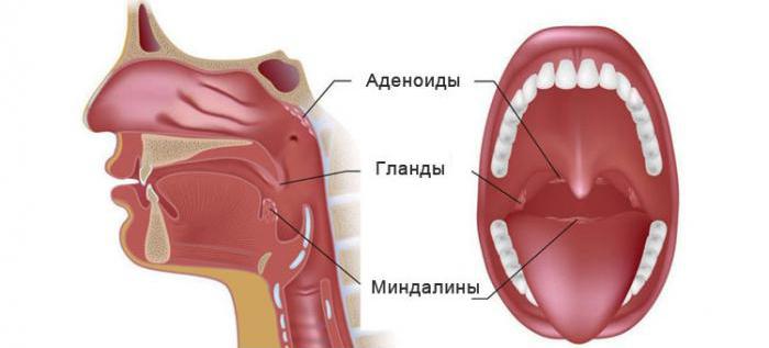 adenoid hipertrofisi