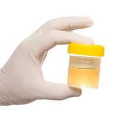  increased mucus in the urine